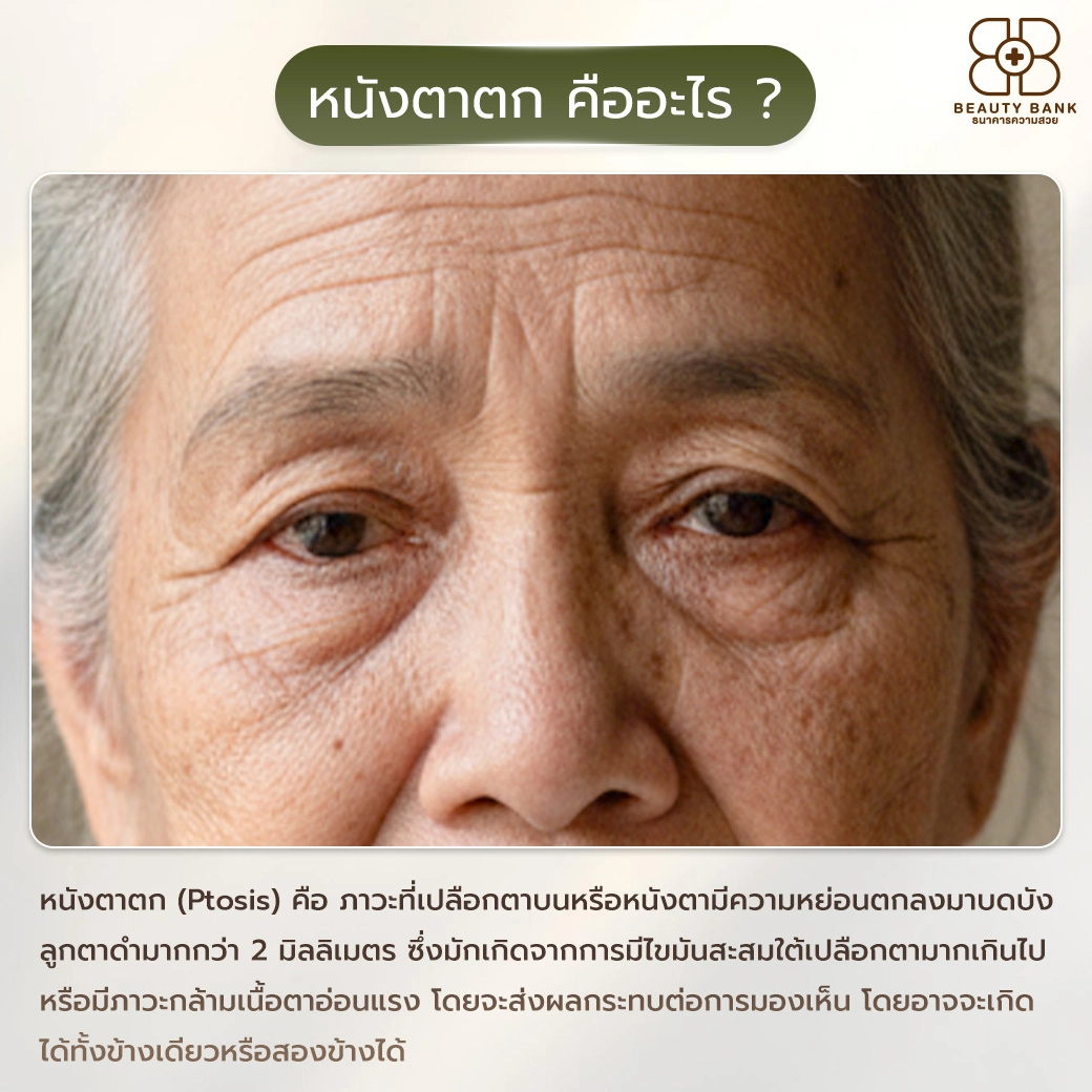 หนังตาตกคืออะไร ?