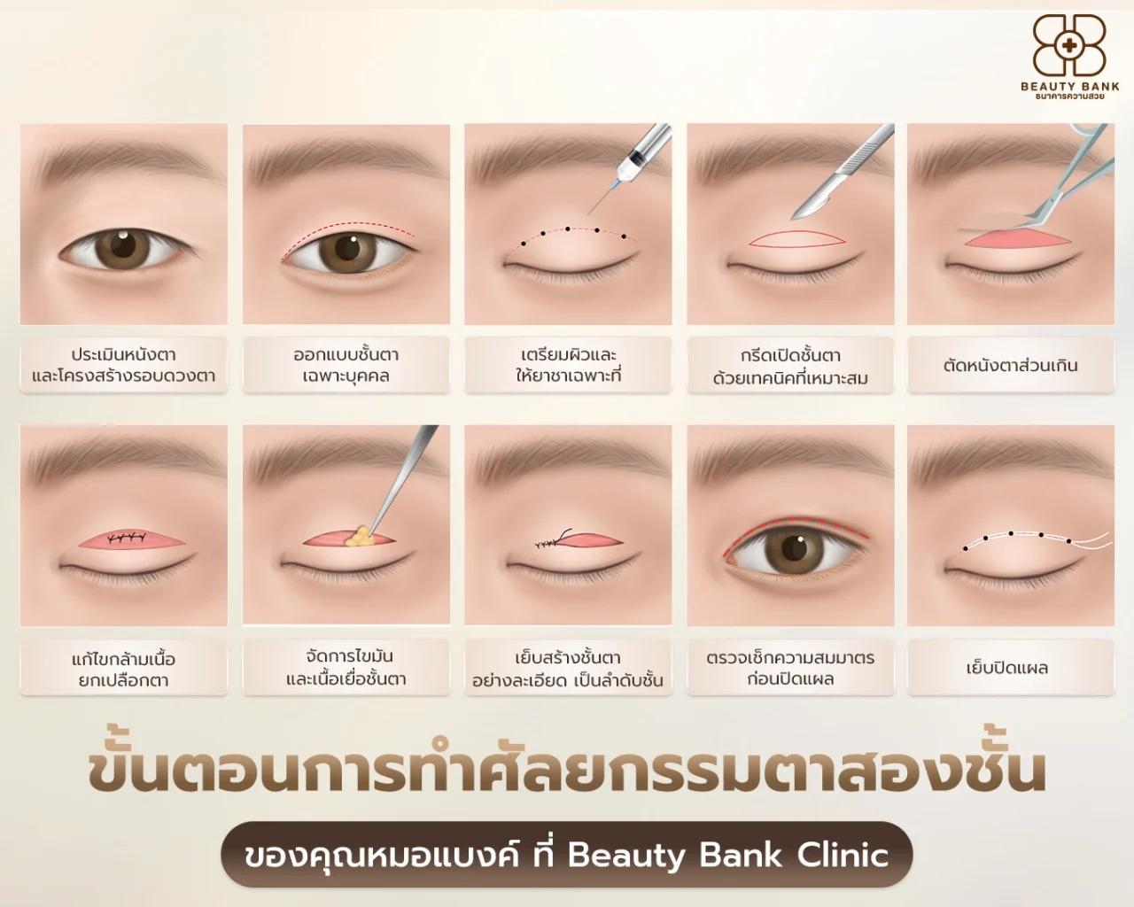 ขั้นตอนการทำตาสองชั้น