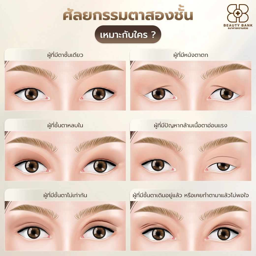 ตาสองชั้นเหมาะกับใคร