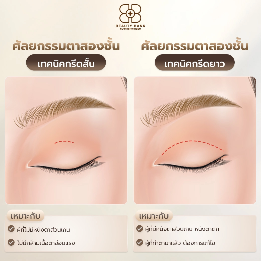 ตาสองชั้นแบบกรีดชั้นตา