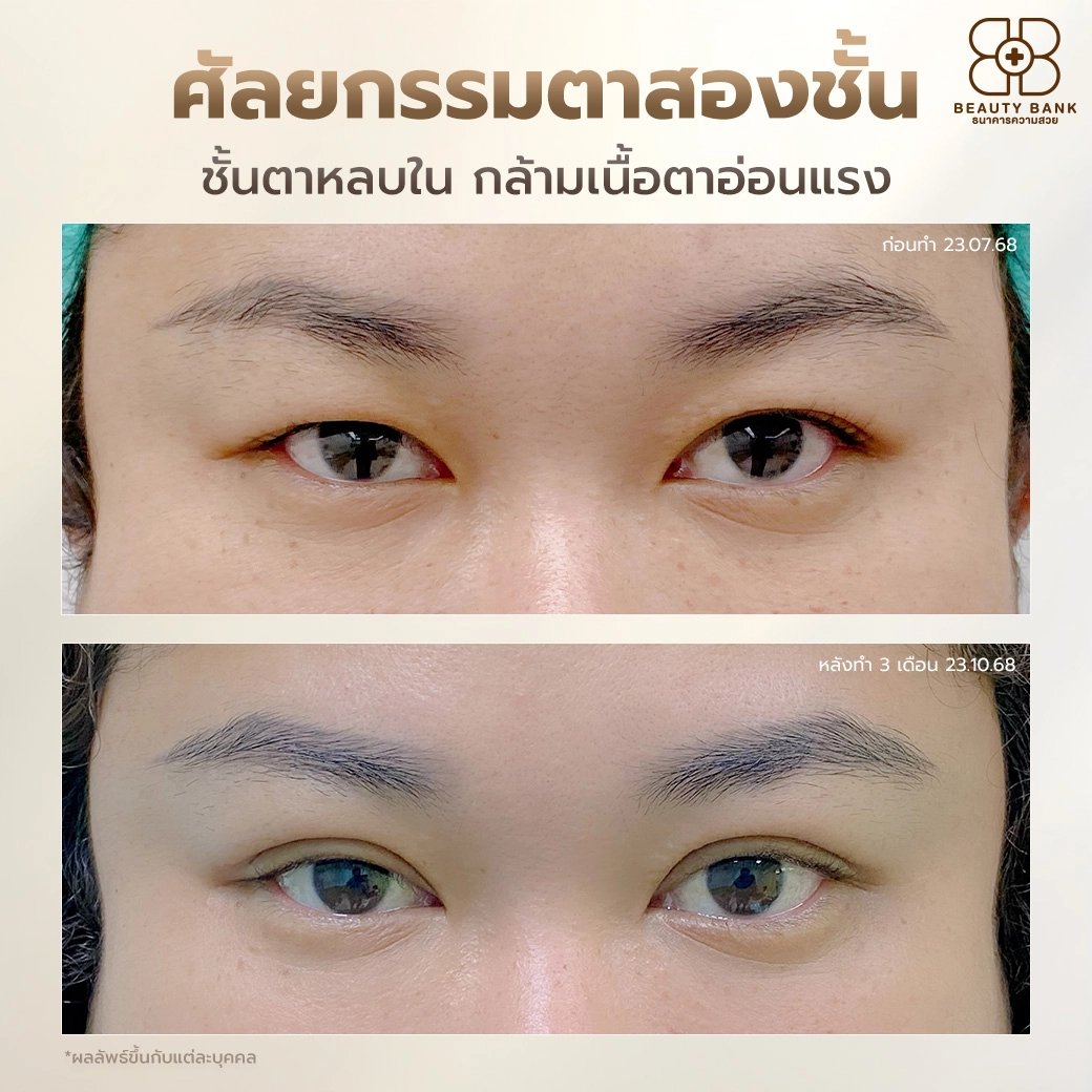 Review ตาสองชั้น