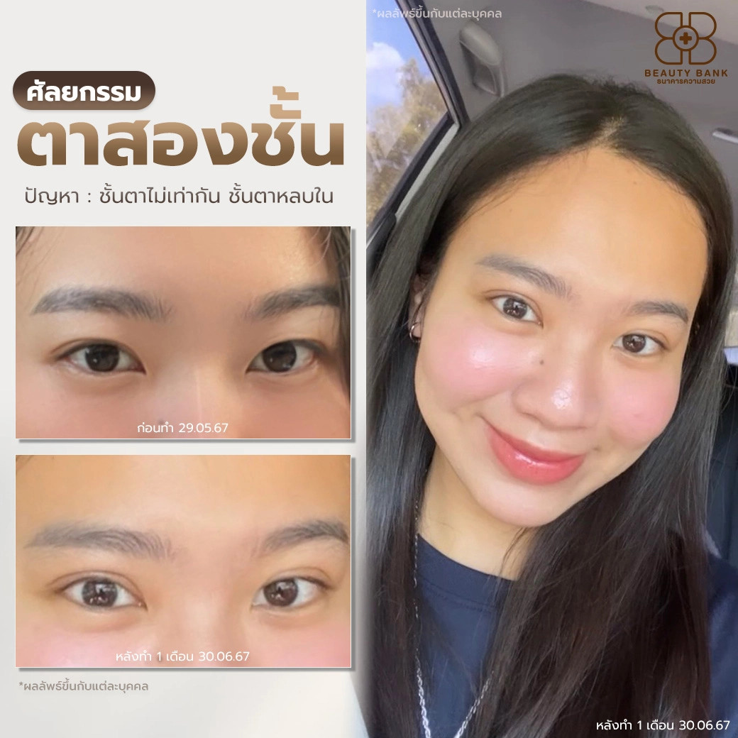 คลินิกแก้ไขชั้นตาหลบใน จังหวัดตราด