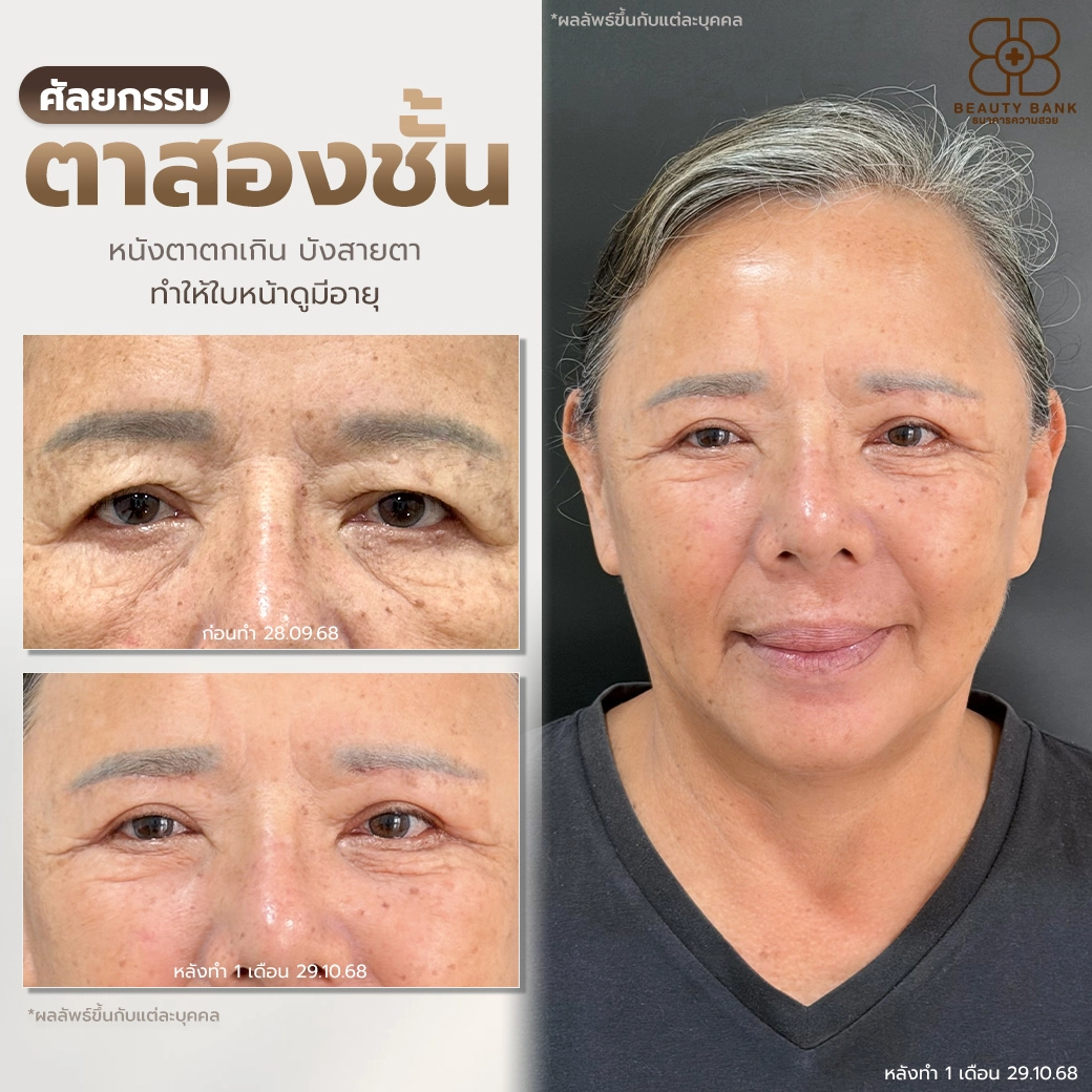 คลินิกแก้ไขหนังตาตก ตราด