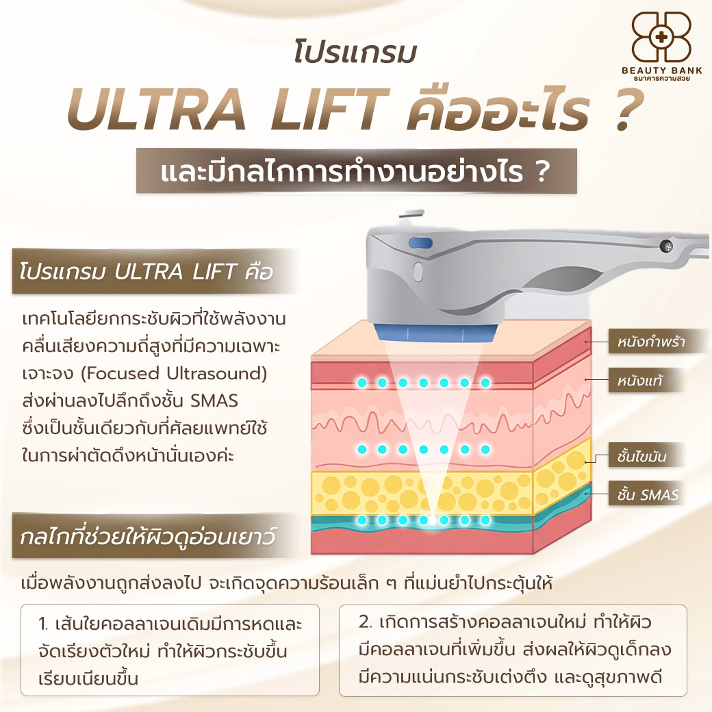 ultra lift คืออะไร