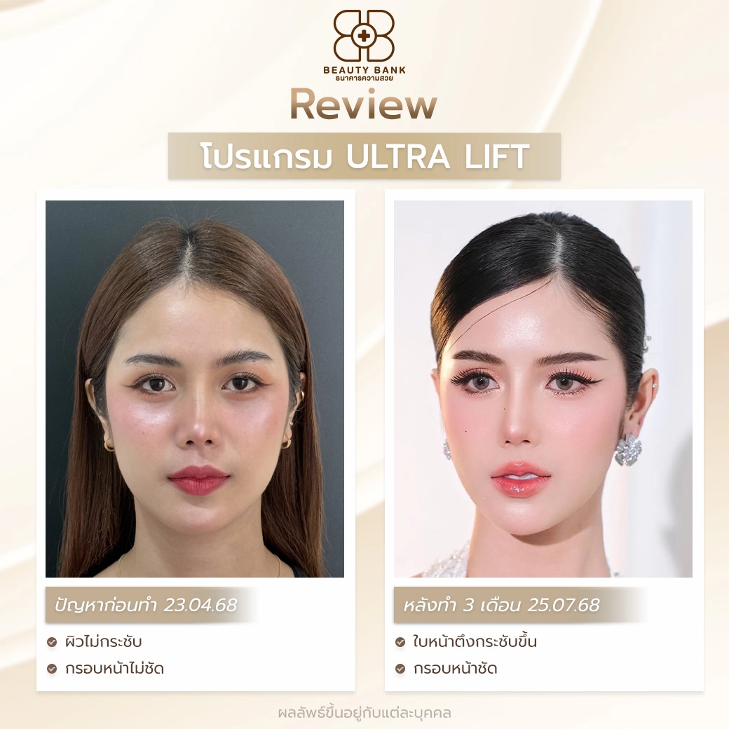 ทำ ultra lift ที่ไหนดี จ.ตราด