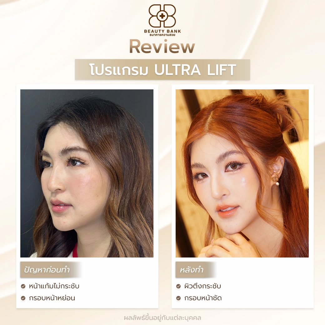 ultra lift ใกล้ฉัน